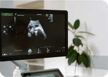 Monitor de ecografía