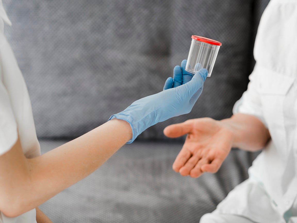 Toma de Muestra laboratorio
