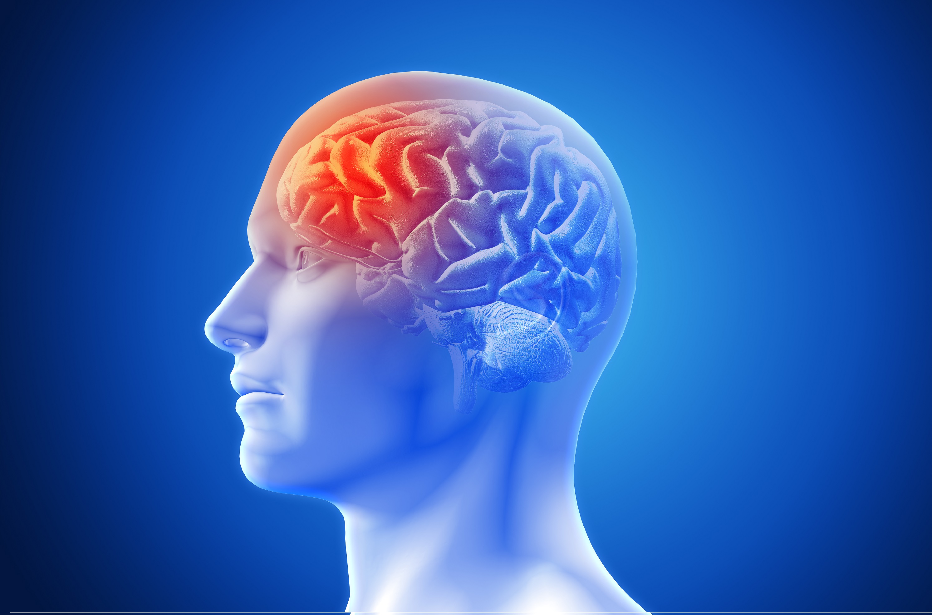 Importancia del Tiempo en el Diagnóstico de Enfermedades Cerebro Vasculares